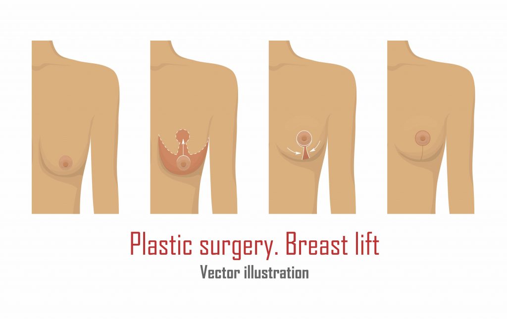 Plastic Surgery
